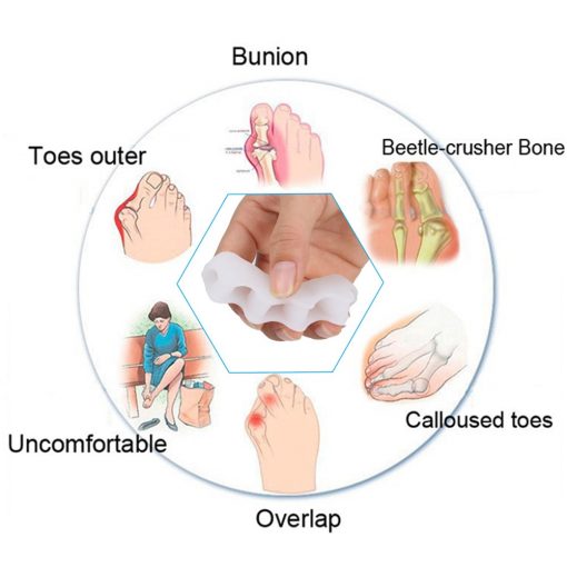 Orthopedic Hammer Toe Corrector - Image 3