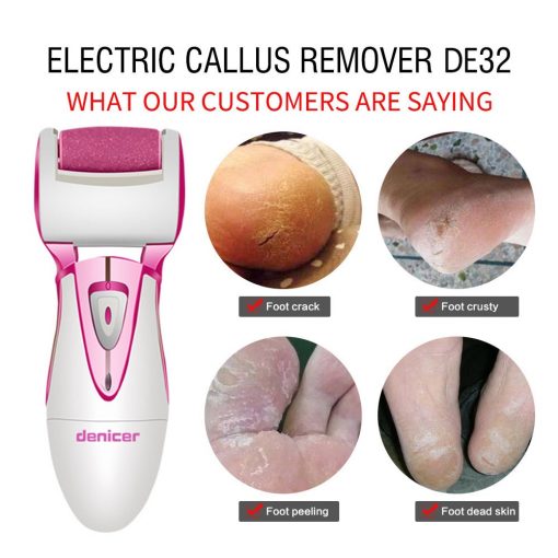 Powerful Electric Foot Callus Remover - Image 2